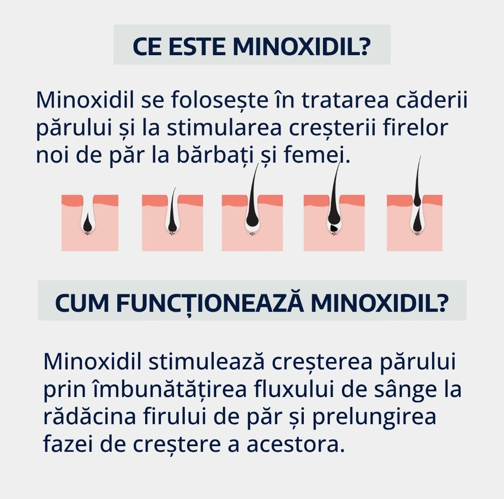 Soluție MenHub Minoxidil 5%, tratament împotriva căderii părului