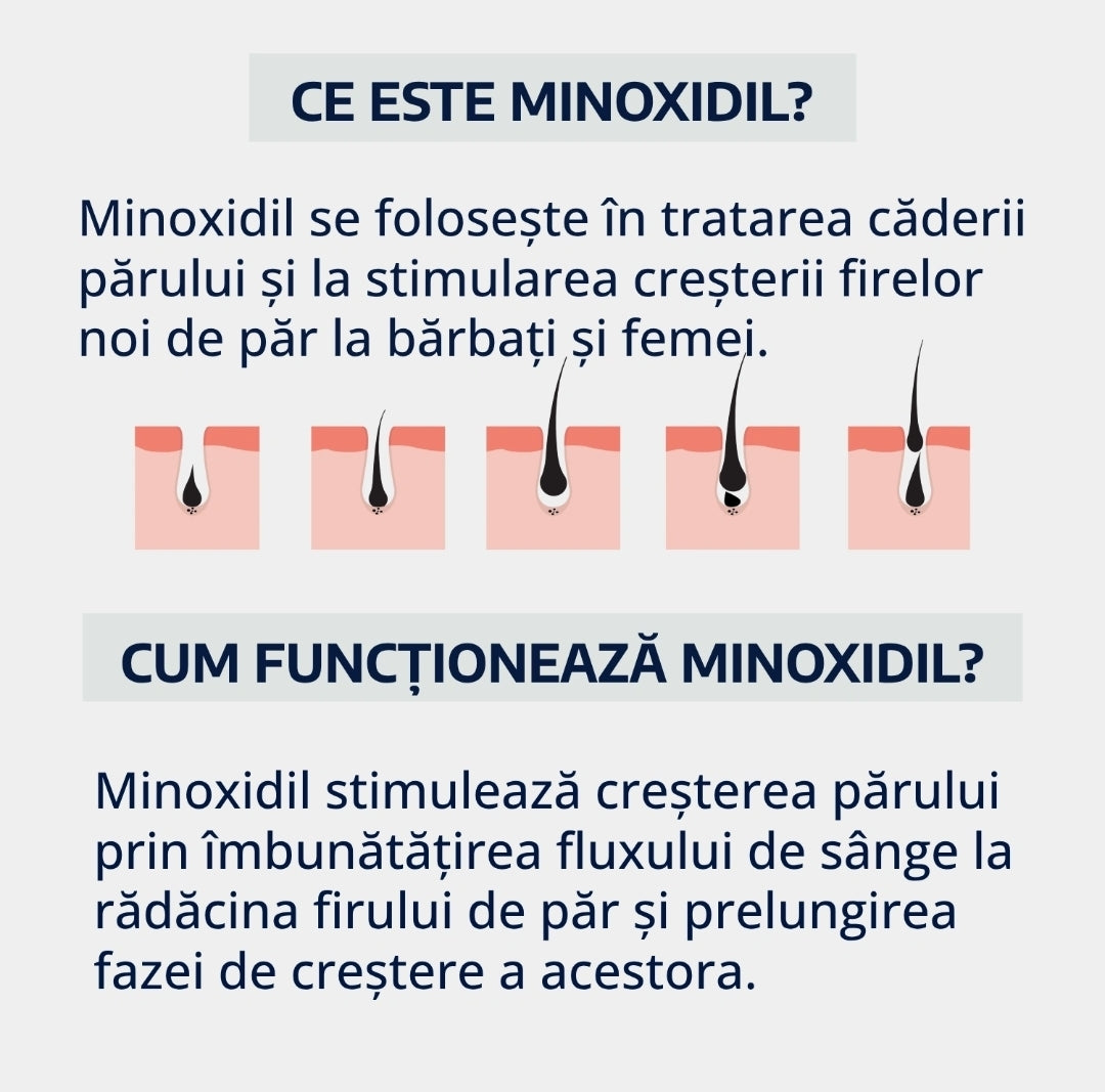 Soluție MenHub Minoxidil 5%, tratament împotriva căderii părului
