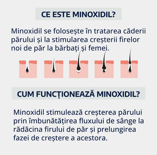 Soluție MenHub Minoxidil 5%, tratament împotriva căderii părului